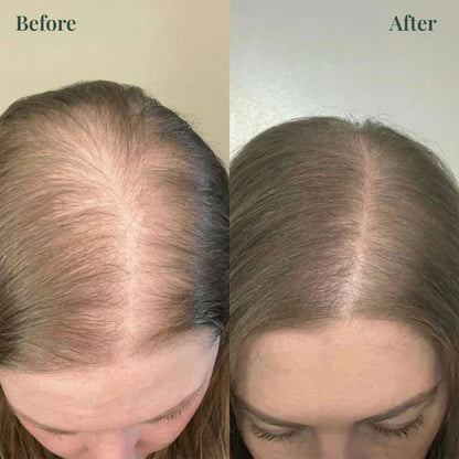 Kerarose™ Rosemary Shampoo