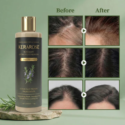 Kerarose™ Rosemary Shampoo